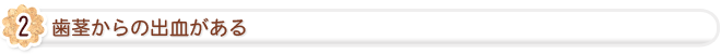 歯茎から出血する