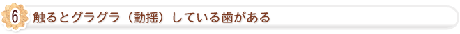 触るとグラグラ（動揺）している歯がある